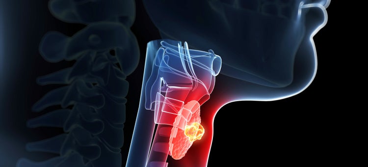 Why Thyroid Conditions Are So Bad