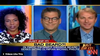 Beard Apology Not Enough For CNN, The World