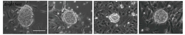 Scientists Have Created Functional Sperm From Stem Cells