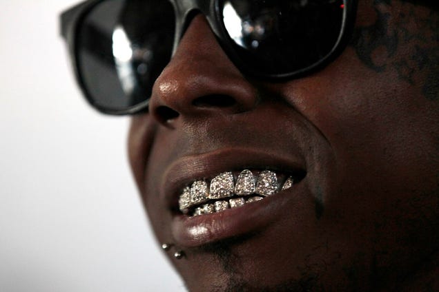 Rapper S Dog Diamond Teeth Rapper S Dog Diamond Teeth