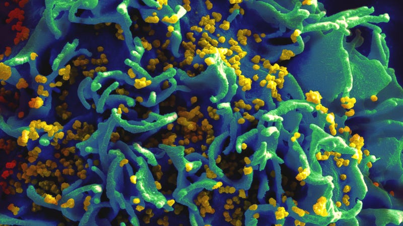 HIV Genes Successfully Edited Out of Immune Cells