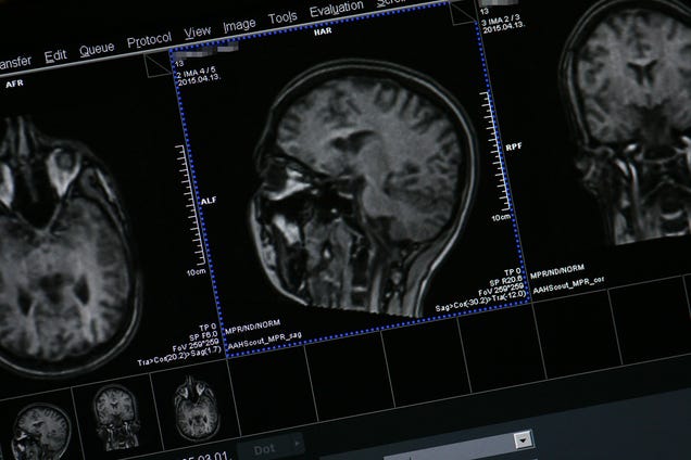 This Siemens MRI Scanner Is a Beautiful Machine That Saves Lives