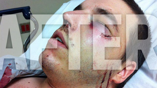 Community Rallies To Support The Cabbie Beaten To A Pulp By A US Marine