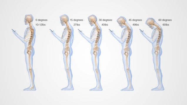 This Is What Looking Down at Your Cell Phone Does to Your Spine