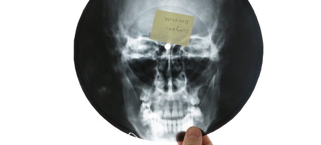 The Bizarre History of X-Ray Records and Early Music Piracy