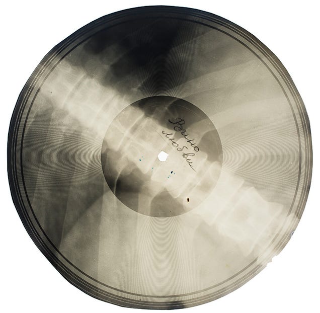 Ever Heard of a Record Pressed On an X-Ray?