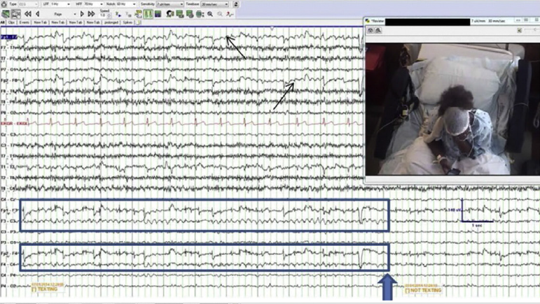 Texting Produces an Entirely New Kind of Brain Wave Pattern