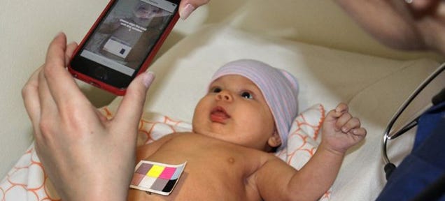 App Turns Your Phone's Camera Into a Jaundice-Detecting Pediatrician