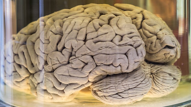 Univ. of Texas Can't Figure Out Where 100 Jars of Brains Went