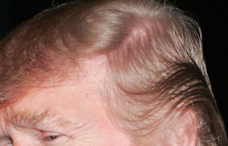 Is Donald Trump’s Hair a $60,000 Weave? A Gawker Investigation
