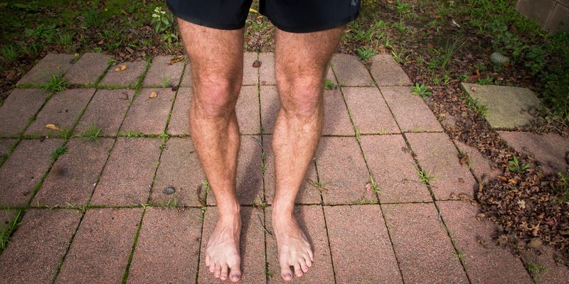 Doctor insights on: Brown Patches On Legs What Causes It