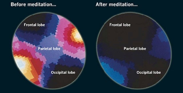 What Happens to the Brain When You Meditate (And How it Benefits You)