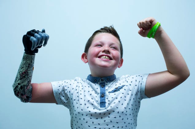 Kid Gets Awesome New Bionic Hand, Reminds Us Not Everything is Garbage