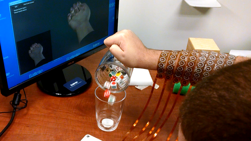 Brain Implant Enables Quadriplegic Man to Play Guitar Hero With His Hands