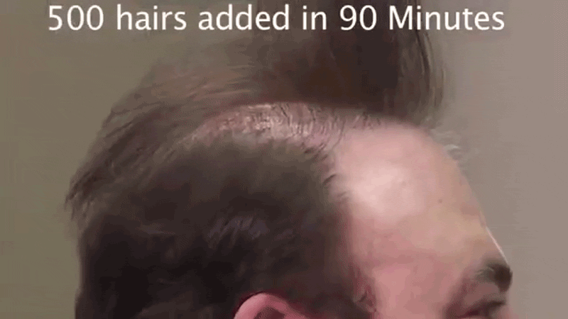 Is Donald Trump’s Hair a $60,000 Weave? A Gawker Investigation