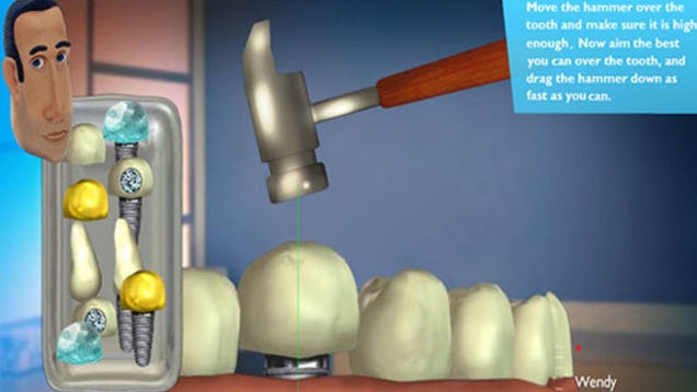 This Week's iPhone Charts: The Cheapest Dental Surgery Available