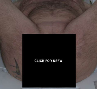 "I Still Unload": This Man Is a "Nullo" Who Removed His Penis and Balls