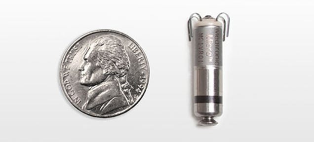 This Tiny Metal Pill Is the Smallest Pacemaker Ever Implanted