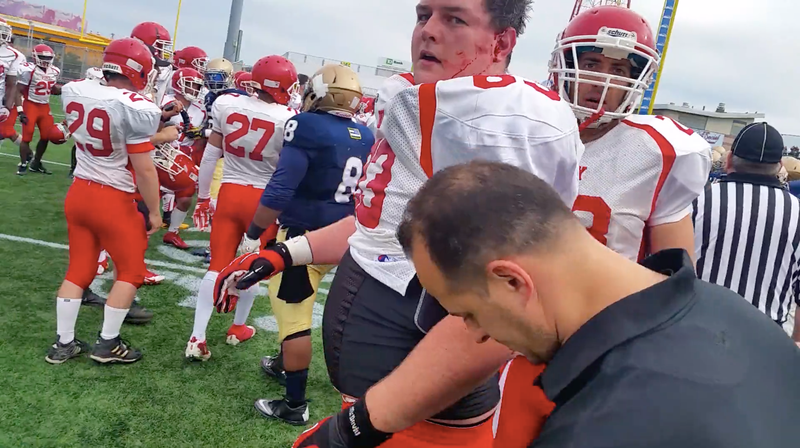 FDNY/NYPD Football Game Devolves Into Fisticuffs