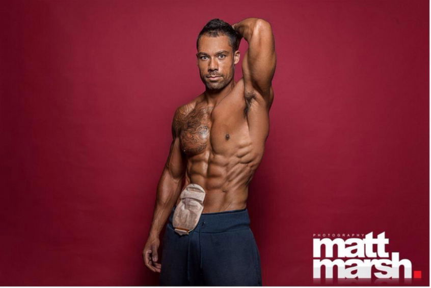 Male Bodybuilding Model Shows Off His Colostomy Bag Jezebel Body Building News Newslocker
