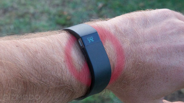 rash from fitbit band