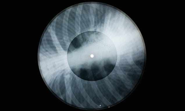 Ever Heard of a Record Pressed On an X-Ray?