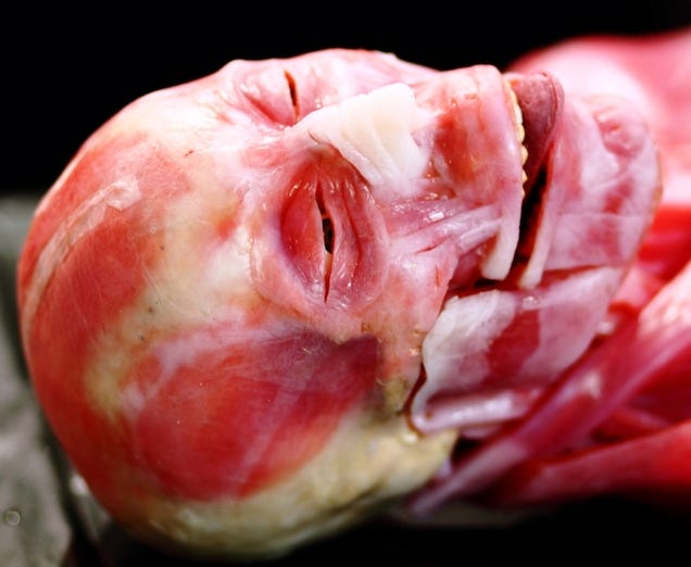 This Freakish Skinless Body Is Actually A Synt