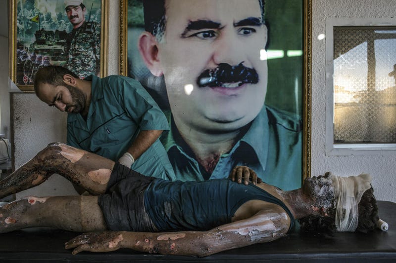 Las mejores fotos de prensa de 2015 muestran la cara más brutal del hombre y la naturaleza