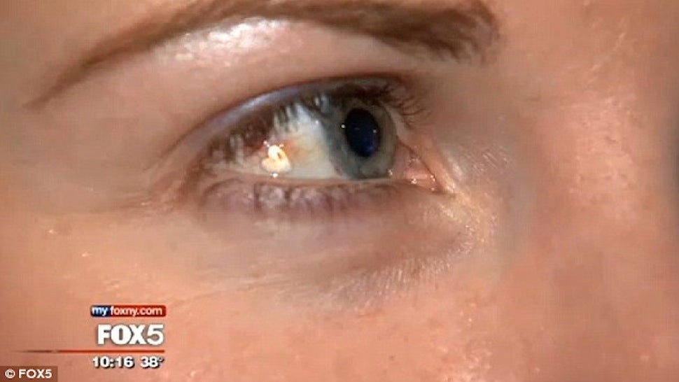 Woman Has HeartShaped Twinkle Surgically Implanted On Her Eyeball