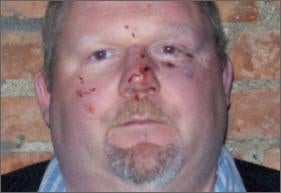 A Restaurateur's Revenge? Food Critic Beaten Up