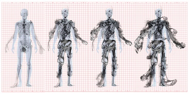 These Cancer-Deformed Skeletons Are Inspiring the Design of a Building