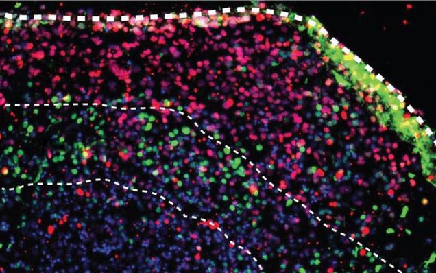 Scientists are Growing Tiny Cerebral Cortexes in Petri Dishes