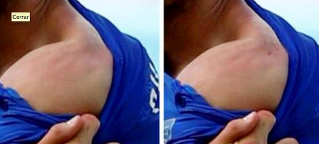 Uruguay Claims the Luis Suárez Soccer Bite Is a Photoshop Hoax