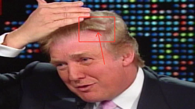 Is Donald Trump’s Hair a $60,000 Weave? A Gawker Investigation
