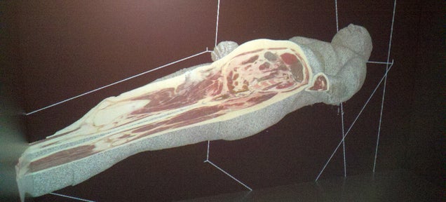 Train for Surgery Using Immersive 3D Holograms of Corpses