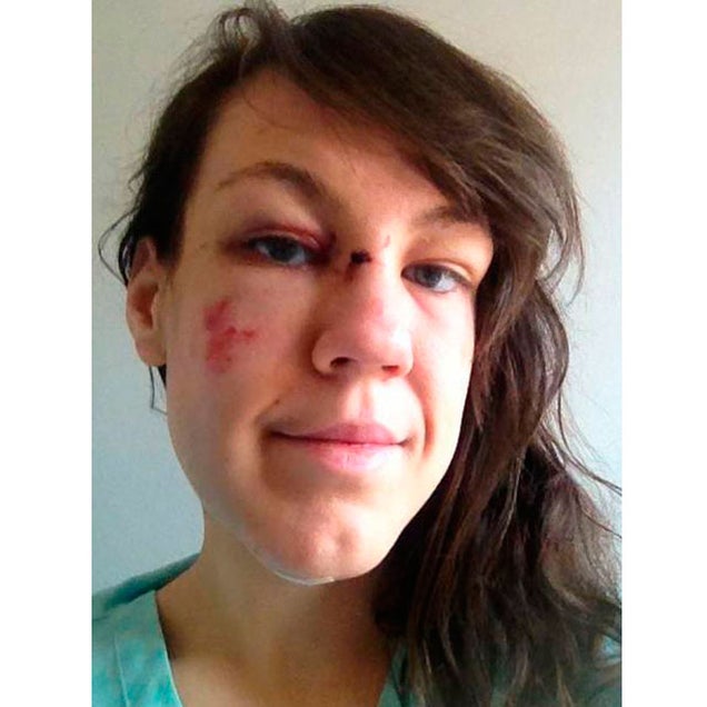 Woman Attacked Uses #nomakeupselfie to Raise Money For Rape Victims