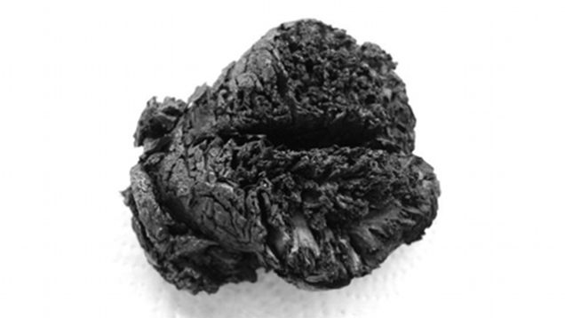 This 4,000-Year-Old Brain Was Burned, Boiled, Shaken, and Is Still Intact