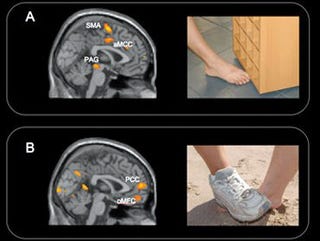Brain Scans Reveal that Teen Bullies Get Pleasure from Your Pain