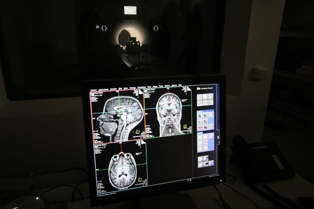 This Siemens MRI Scanner Is a Beautiful Machine That Saves Lives