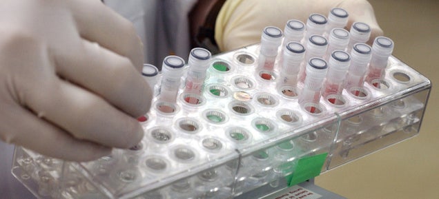 France Lost Thousands of Vials Containing the SARS Virus