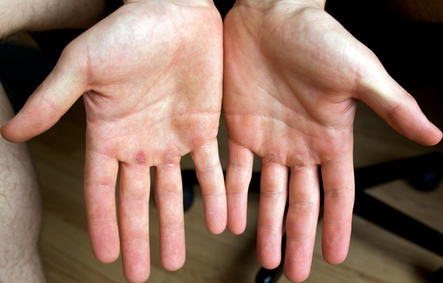 Use a Padded Jump Rope to Prevent Calluses At the Gym