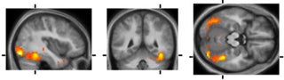 How Hatred Transforms Your Brain