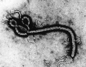Possible Cure for Ebola Could Revolutionize Antivirals
