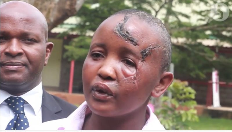 Infertile Kenyan Man Accused of Cutting off Wife's Hands After They Couldn't Have Children 