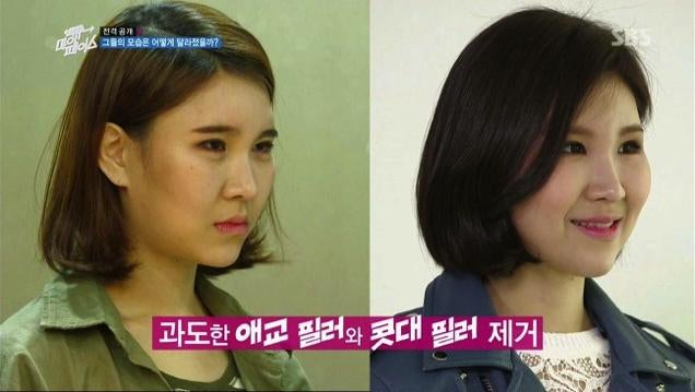 Depressing? Inspirational? Reverse Plastic Surgery Show Hits Korea