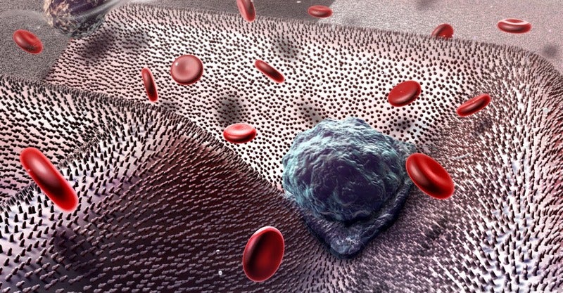 The Way Cancer Cells Spread Is Even Scarier Than We Thought