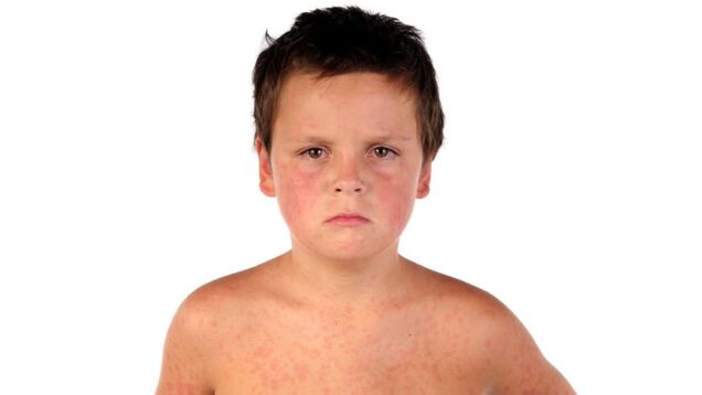 Vaccines Don't Cause Autism, Please Vaccinate Your Children