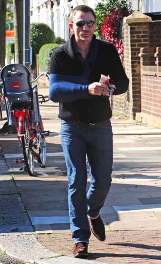 Daniel Craig Needs Someone To Kiss His Boo Boo