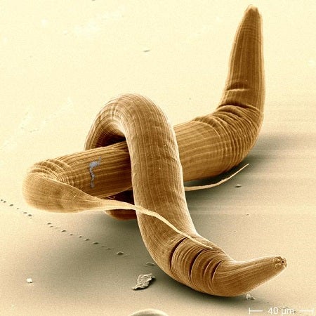 Why Self-Fertilizing Worms Have Shorter Lifespans
