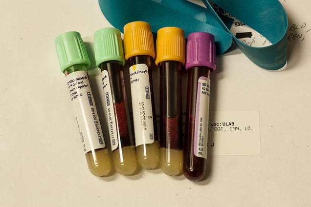Learn to Read Your Blood Test Results Before Your End-of-Year Physical